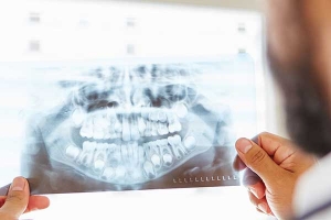 cirugia-maxilofacial