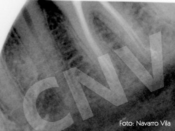 endo3