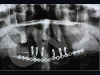 radiografia-de-control_1